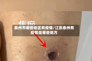 泰州市哪些地区有疫情/江苏泰州有疫情是哪些地方